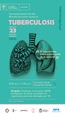 Tuberculosis